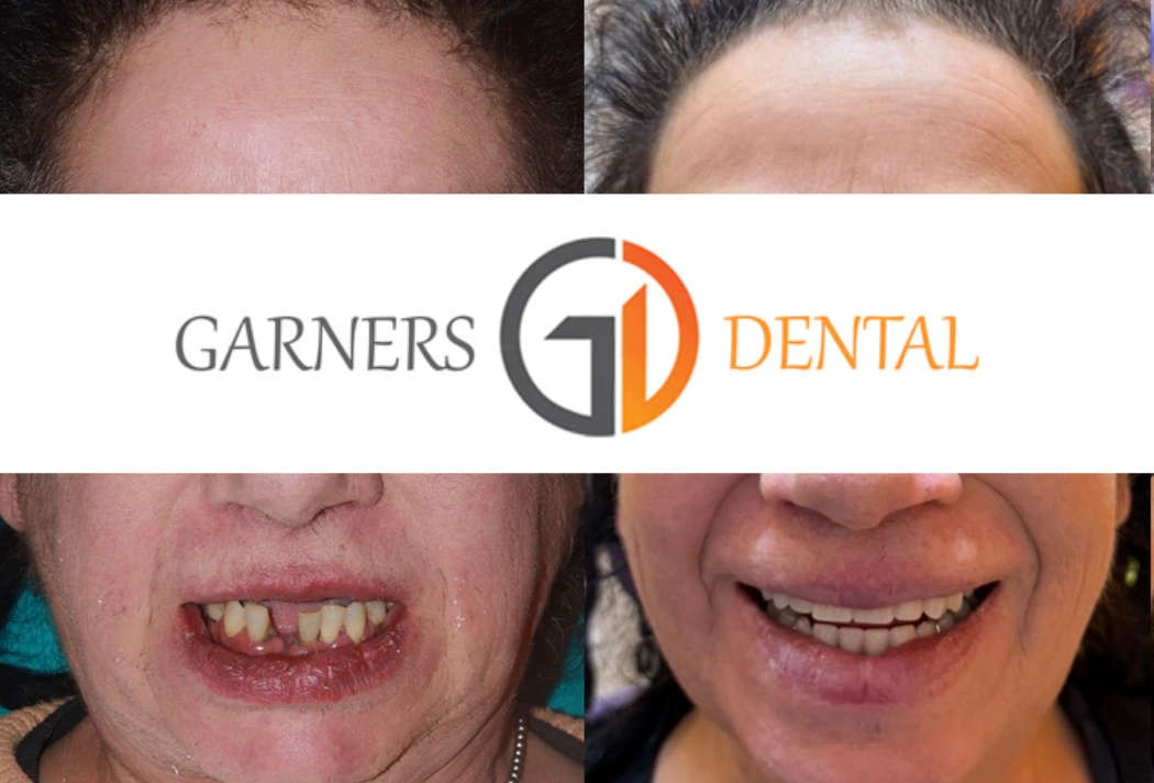 Before and After Photos - 12